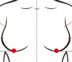 妇科疾病（乳腺增生）—取穴参考方案(图1)