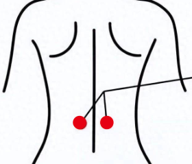 心脑血管疾病（动脉硬化）—取穴参考方案(图2)