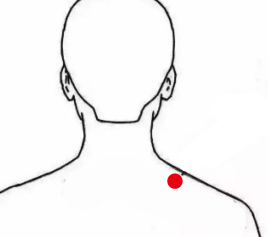 妇科疾病（乳腺炎）—取穴参考方案(图2)