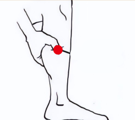 心脑血管疾病（高血脂）—取穴参考方案(图2)