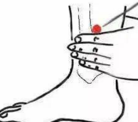 妇科疾病（月经不调）—取穴参考方案(图1)