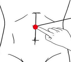 心脑血管疾病（脂肪肝）—取穴参考方案(图2)