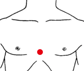 心脑血管疾病（冠心病）—取穴参考方案(图1)