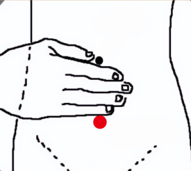 妇科疾病（子宫内膜异位症）—取穴参考方案(图2)