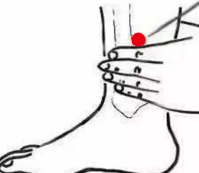 心脑血管疾病（慢性肾炎）—取穴参考方案(图3)