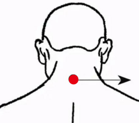 心脑血管疾病（动脉硬化）—取穴参考方案(图1)
