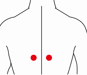 妇科疾病（神经衰弱）—取穴参考方案(图3)