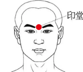 妇科疾病（焦虑）—取穴参考方案(图3)