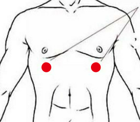 心脑血管疾病（胆结石）—取穴参考方案(图1)