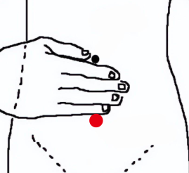 妇科疾病（慢性盆腔炎）—取穴参考方案(图2)