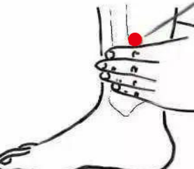 心脑血管疾病（中风后遗症下肢瘫）—取穴参考方案(图3)