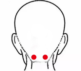 妇科疾病（神经衰弱）—取穴参考方案(图2)