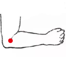 心脑血管疾病（荨麻疹）—取穴参考方案(图1)