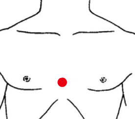 妇科疾病（乳腺增生）—取穴参考方案(图3)