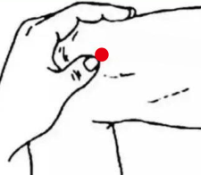 心脑血管疾病（荨麻疹）—取穴参考方案(图2)