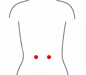 男科疾病（前列腺增生）—取穴参考方案(图3)