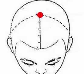 心脑血管疾病（中风后遗症失语）—取穴参考方案(图3)