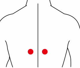 妇科疾病（痤疮）—取穴参考方案(图3)