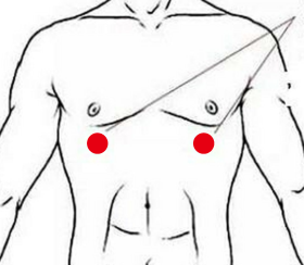 心脑血管疾病（胆囊炎）—取穴参考方案(图1)