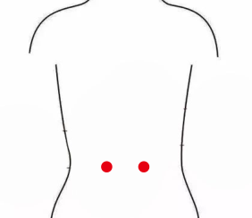 男科疾病（肾病综合症）—取穴参考方案(图1)