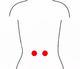 心脑血管疾病（中风后遗症下肢瘫）—取穴参考方案(图1)