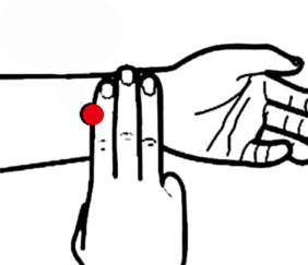 心脑血管疾病（中风后遗症失语）—取穴参考方案(图2)