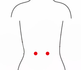 男科疾病（遗尿）—取穴参考方案(图3)