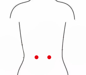 心脑血管疾病（急性肾炎）—取穴参考方案(图1)