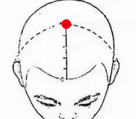 妇科疾病（神经衰弱）—取穴参考方案(图1)