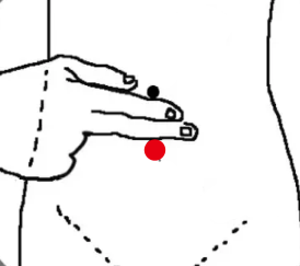 妇科疾病（子宫脱垂）—取穴参考方案(图2)