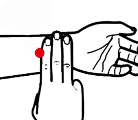 心脑血管疾病（冠心病）—取穴参考方案(图3)