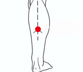 心脑血管疾病（静脉曲张）—取穴参考方案(图2)