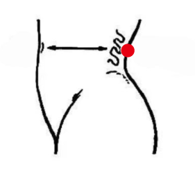 男科疾病（不孕不育）—取穴参考方案(图2)