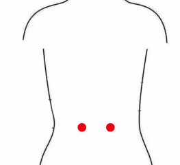 妇科疾病（卵巢早衰）—取穴参考方案(图3)