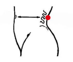 妇科疾病（多囊卵巢综合症）—取穴参考方案(图2)