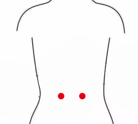 妇科疾病（更年期综合症）—取穴参考方案(图1)