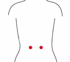 妇科疾病（多囊卵巢综合症）—取穴参考方案(图1)