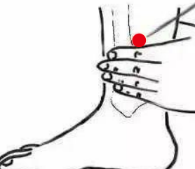 妇科疾病（多囊卵巢综合症）—取穴参考方案(图3)